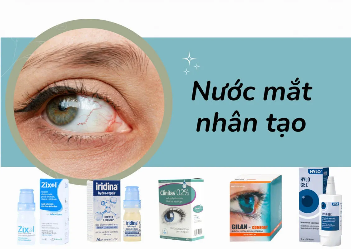 6 Nhóm nước mắt nhân tạo ai cũng nên biết