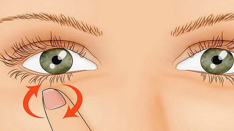 Co giật mí mắt có nguyên nhân do đâu? Cách khắc phục