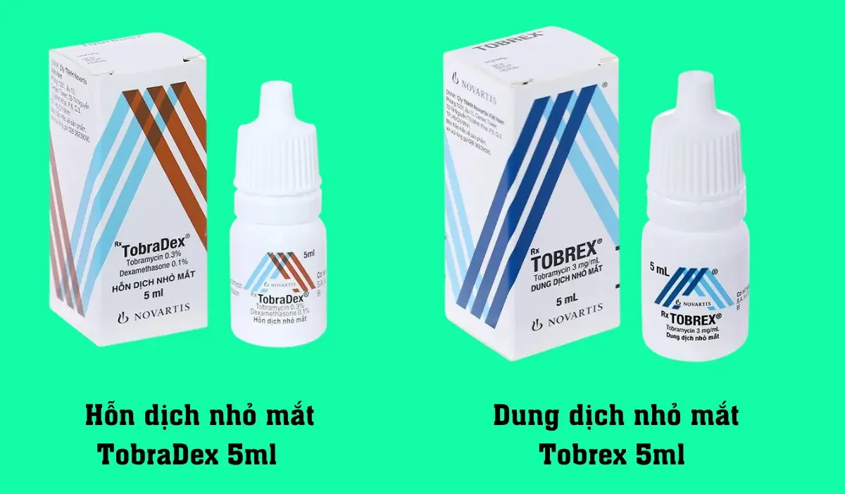 Thuốc nhỏ mắt Tobradex chống viêm và nhiễm trùng cực hiệu quả