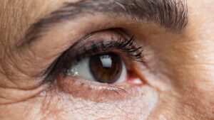 THOÁI HÓA ĐIỂM VÀNG – DẤU HIỆU, NGUYÊN NHÂN VÀ PHƯƠNG PHÁP ĐIỀU TRỊ